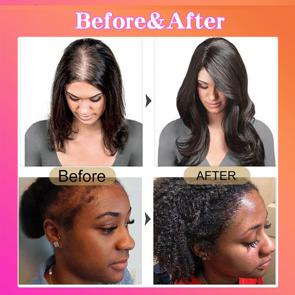 Batana Oil for Hair Growth, Unrefined Organic Pure Batana Butter Conditioner T8133